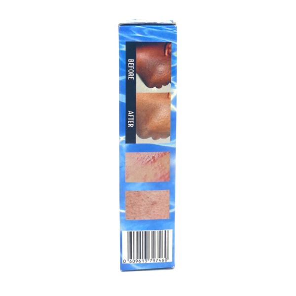 Nyxon Bump Control - Lotion anti-boutons coiffure et rasage